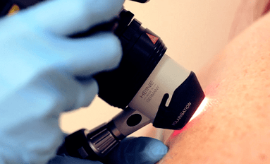 Metode de diagnostic pentru negiul plantar