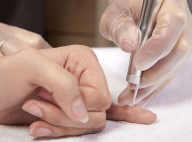 Efectuarea terapiei cu laser